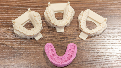 Four impressions of a patient's teeth