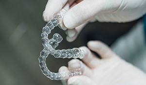 Dental professional holding two clear aligners