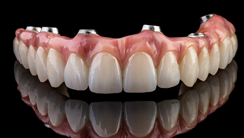 Close up of an implant denture