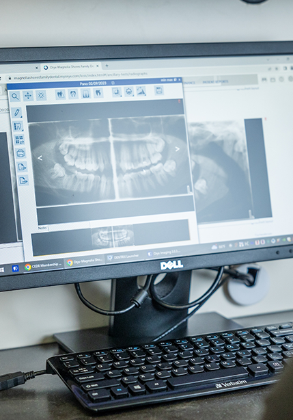 Computer screen showing x rays of teeth