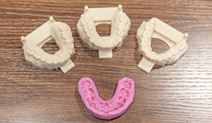 Molds of teeth and dentures