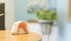 Model of an implant denture on a table