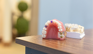 Model of implant dentures