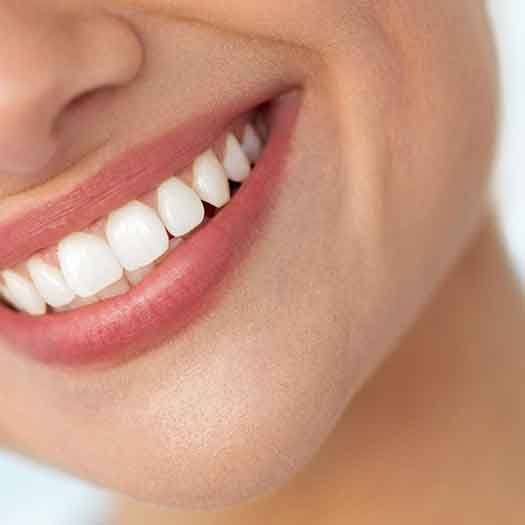 Closeup of a woman smiling